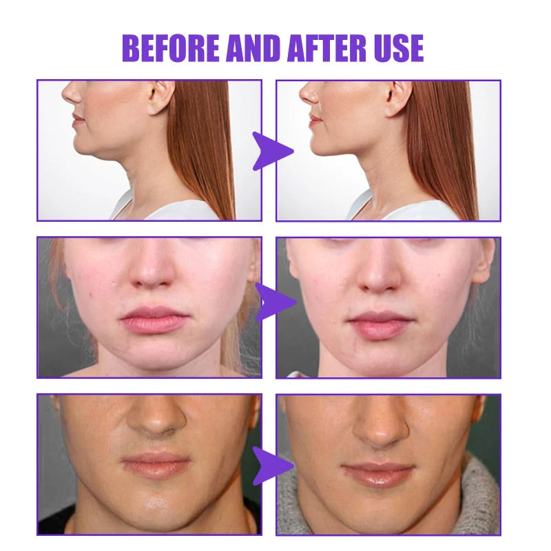 V-Shape Firming Slimming Face-lift Cream Harmless Removal Double Chin Face Fat Burning Anti-aging Products Beauty Health