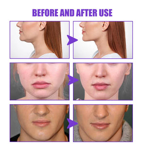 V-Shape Firming Slimming Face-lift Cream Harmless Removal Double Chin Face Fat Burning Anti-aging Products Beauty Health